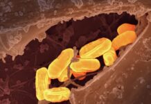 ‘개인 맞춤형 식단’ 트렌드, 건강관리의 새 기준으로 자리 잡다 a close up of a cell phone with a yellow substance on it