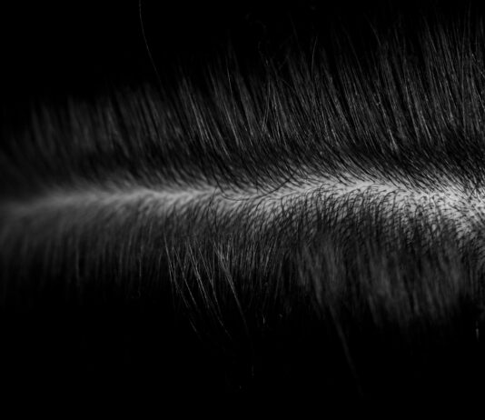 건강한 두피와 모발, 일상 속 작은 변화가 미래를 바꾼다 a black and white photo of some hair